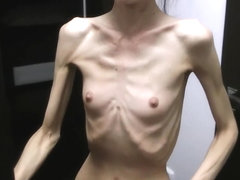 Anorexic Denisa posing and has ribs touched