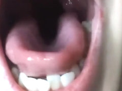 yawn close up